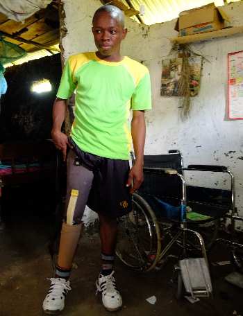 Unterst&uuml;tzter Student mit Beinprothese.